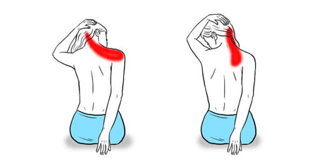 Điều trị viêm quanh khớp vai không mổ tại Hà Nội